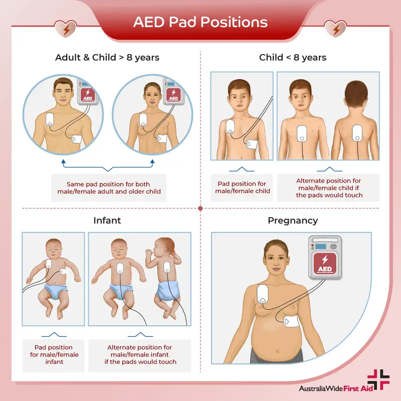 Defibrillation